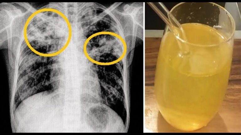 Dieser vergessene Trick befreit sofort von hartnäckigem Husten und lästigem Schleim…