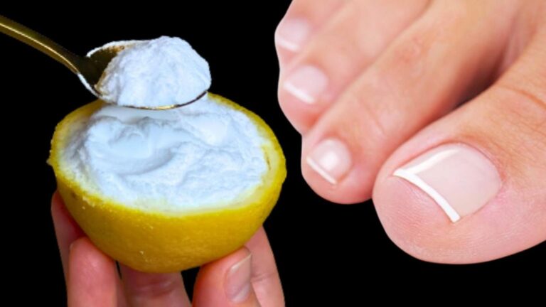 Dieser vergessene Trick macht Nagelpilz im Handumdrehen Geschichte … entdecke die Lösung!